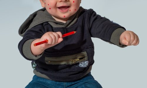 Chickenpox Vaccine for Children: Protecting Your Little Ones from Unnecessary Suffering